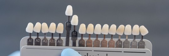 Arzt hält eine Palette an verschiedenen Zahnfarben