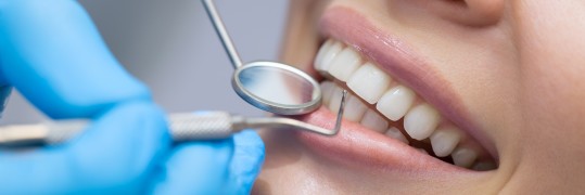 Nahansicht von Zähnen während einer Prophylaxe