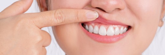 Junge Frau hält die Lippe hoch, um ihr gesundes Zahnfleisch zu zeigen